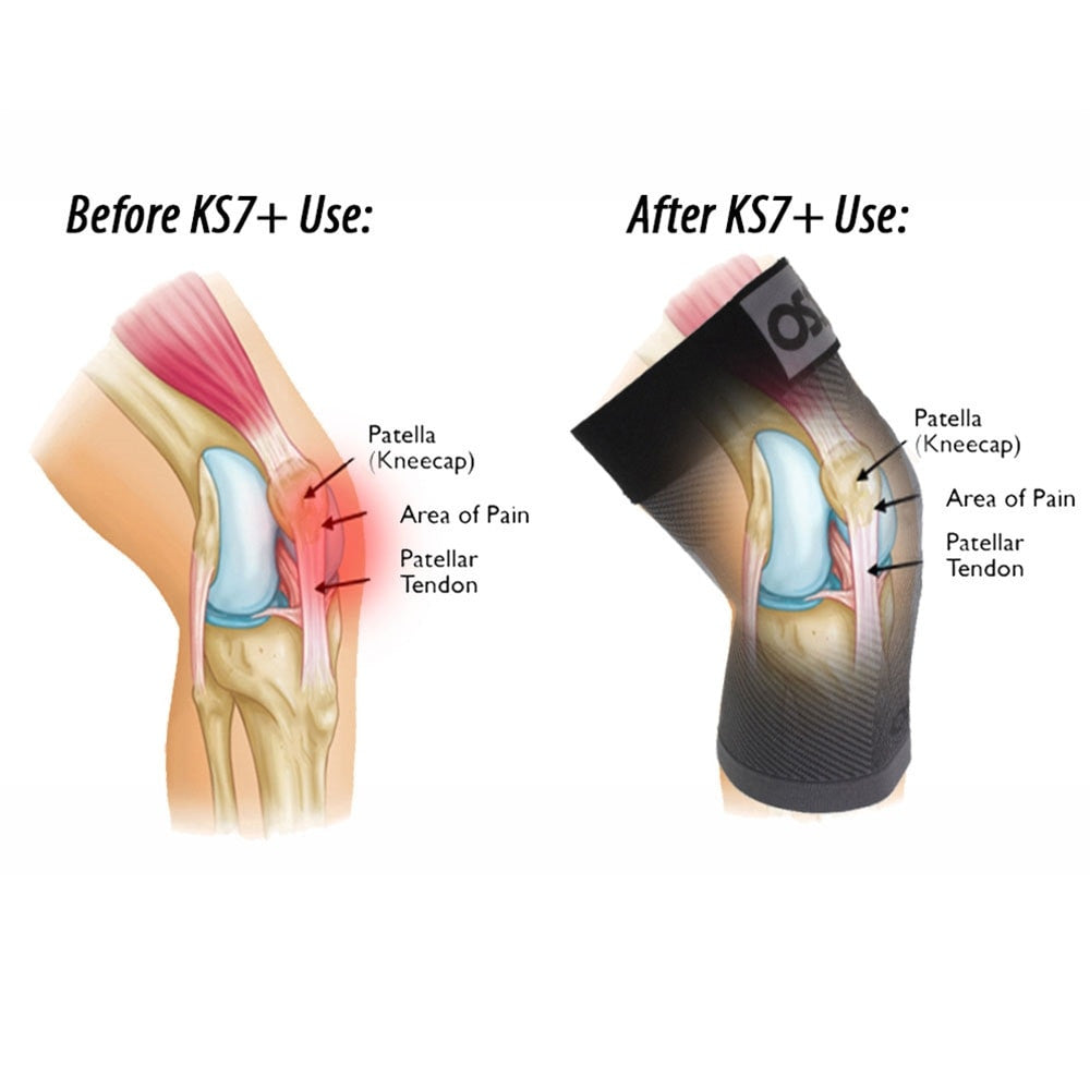 OS1st  KS7+ Adjustable Performance Knee Sleeve - Pickleball Sports Top Pick